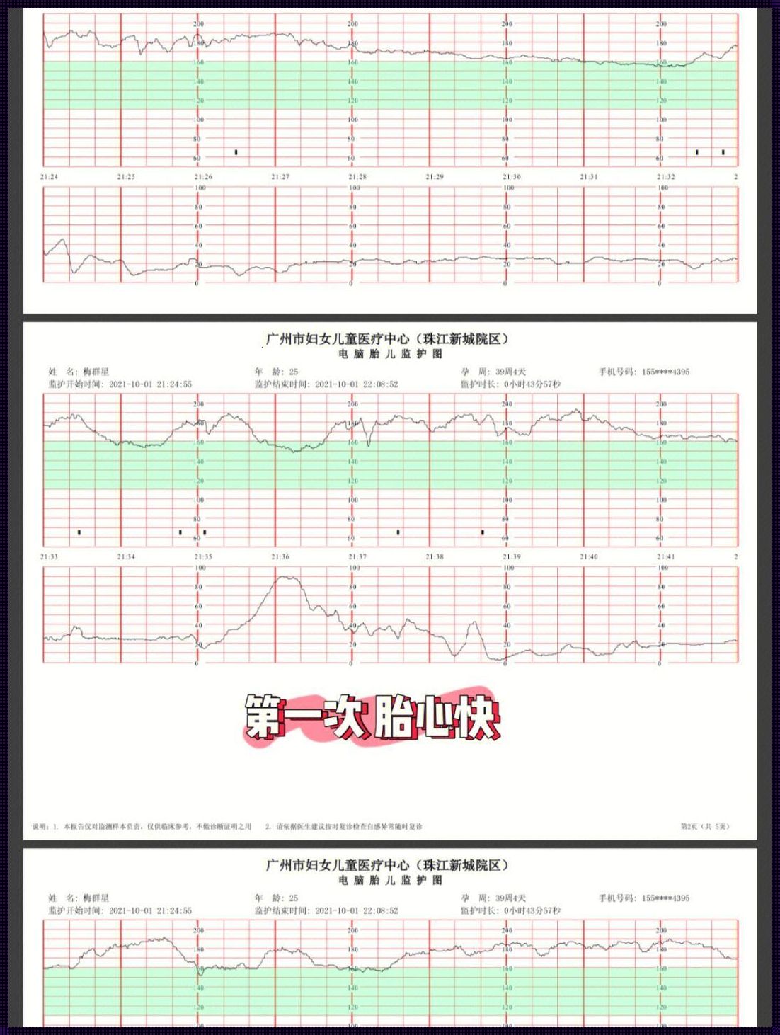 孕晚期胎心监护不过关怎么办？——守护宝宝健康的探究之旅